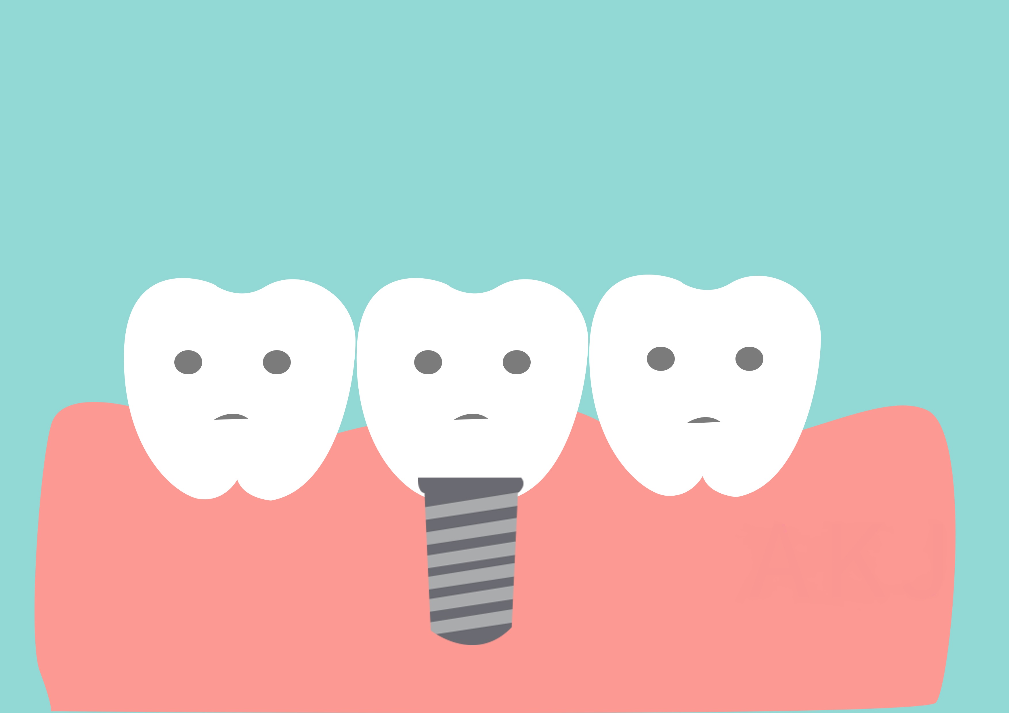 牙齿缺失修复方法的优缺点