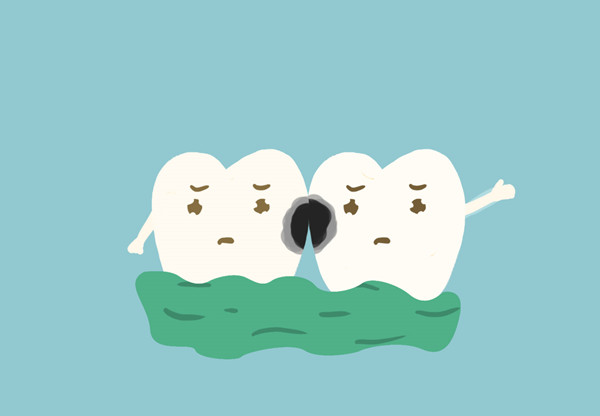 牙齿蛀牙牙洞