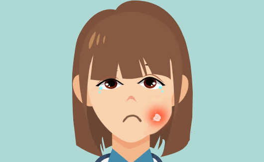 牙痛